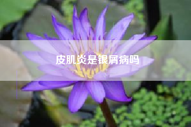 皮肌炎是银屑病吗